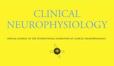מחקר של HIT עם איכילוב יפורסם בכתב העת Clinical Neurophysiology