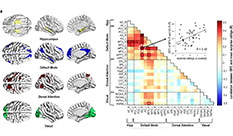 Brain Re-Update - Is a Surprising Moment Captured in the Memory Network?